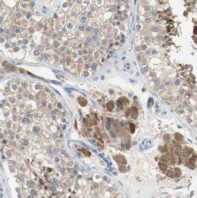 Immunohistochemistry-Paraffin: Mannose Phosphate Isomerase Antibody [NBP1-85787]