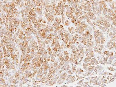 Immunohistochemistry-Paraffin: Mannose Phosphate Isomerase Antibody [NBP2-17215]