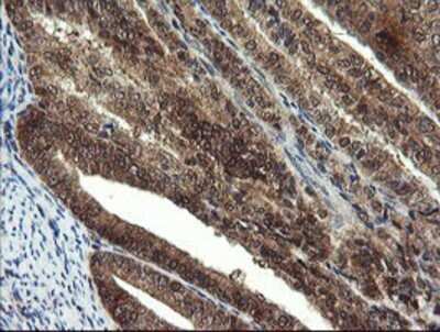 Immunohistochemistry: Mannose Phosphate Isomerase Antibody (OTI1C7) - Azide and BSA Free [NBP2-72582]
