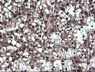 Immunohistochemistry: Mannose Phosphate Isomerase Antibody (OTI1C7) - Azide and BSA Free [NBP2-72582]