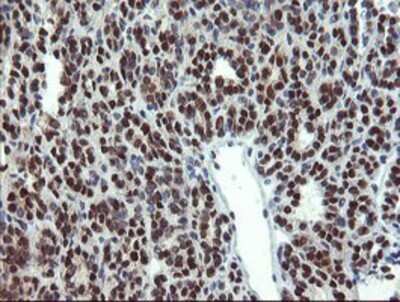 Immunohistochemistry: Mannose Phosphate Isomerase Antibody (OTI1C7) - Azide and BSA Free [NBP2-72582]
