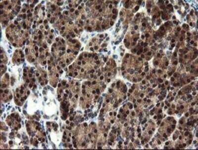 Immunohistochemistry: Mannose Phosphate Isomerase Antibody (OTI1C7) - Azide and BSA Free [NBP2-72582]