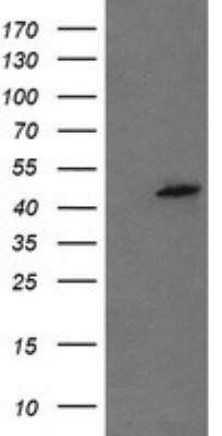 Western Blot: Mannose Phosphate Isomerase Antibody (OTI4G7)Azide and BSA Free [NBP2-72584]