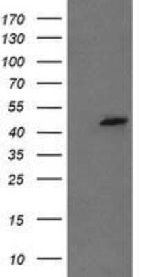 Western Blot: Mannose Phosphate Isomerase Antibody (OTI4G7) [NBP2-45834]