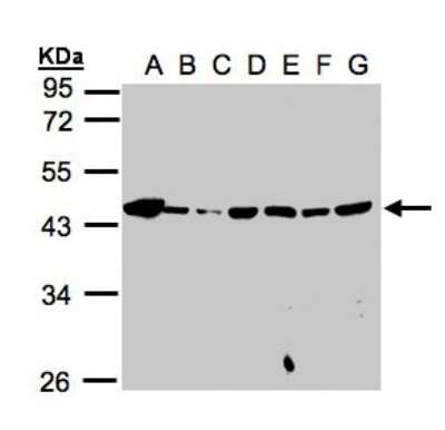 Western Blot: Mannose Phosphate Isomerase Antibody [NBP1-31460]