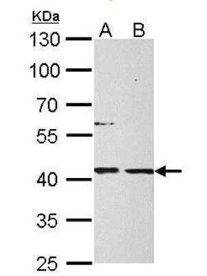 Western Blot: Mannose Phosphate Isomerase Antibody [NBP1-31460]