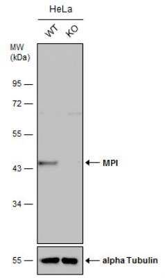 Knockout Validated: Mannose Phosphate Isomerase Antibody [NBP1-31460]