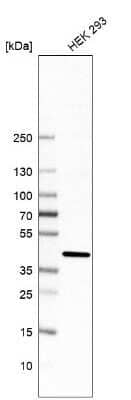 Western Blot: Mannose Phosphate Isomerase Antibody [NBP1-85787]