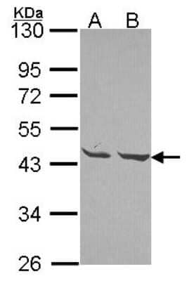 Western Blot: Mannose Phosphate Isomerase Antibody [NBP2-17215]