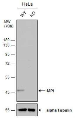 Knockout Validated: Mannose Phosphate Isomerase Antibody [NBP2-17215]