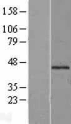 Western Blot: Mannose Phosphate Isomerase Overexpression Lysate [NBL1-13200]