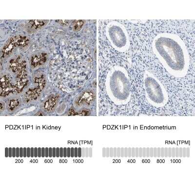 Immunohistochemistry-Paraffin: Map17 Antibody [NBP1-84290]