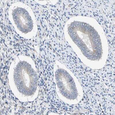 Immunohistochemistry-Paraffin: Map17 Antibody [NBP1-84290]
