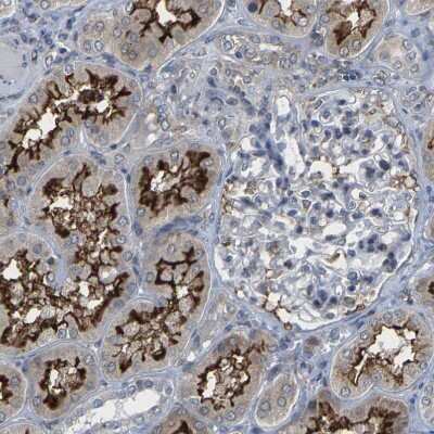 Immunohistochemistry-Paraffin: Map17 Antibody [NBP1-84290]