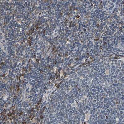 Immunohistochemistry-Paraffin: Map17 Antibody [NBP1-84290]