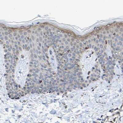Immunohistochemistry-Paraffin: Map17 Antibody [NBP1-84290]