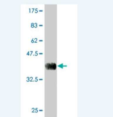 Western Blot: Marapsin/Pancreasin Antibody (6F11) [H00083886-M02]