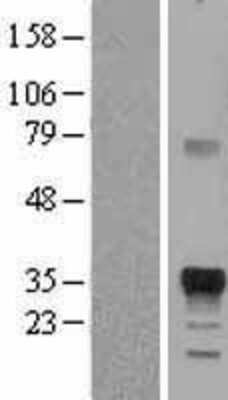 Western Blot: Marapsin/Pancreasin Overexpression Lysate [NBL1-14847]