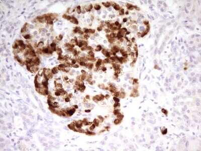 Immunohistochemistry: Mark3 Antibody (OTI2G8) [NBP2-45754]