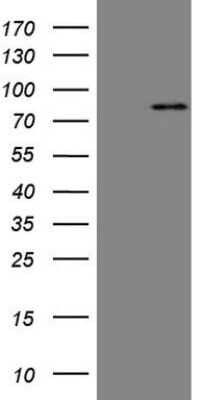 Western Blot: Mark3 Antibody (OTI2G8) [NBP2-45754]