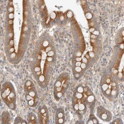 Immunohistochemistry-Paraffin: Mark3 Antibody [NBP1-85389]