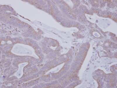 Immunohistochemistry-Paraffin: Mark3 Antibody [NBP2-17225]