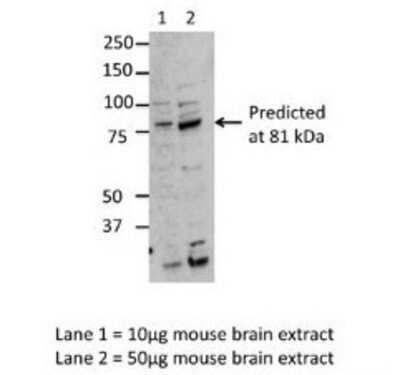 Western Blot: Mark3 Antibody [NBP1-56956]