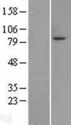 Western Blot: Mark3 Overexpression Lysate [NBL1-12899]