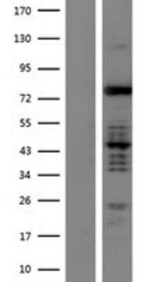 Western Blot: Mark3 Overexpression Lysate [NBP2-09488]