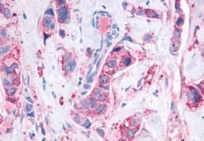 Immunohistochemistry: Mas Antibody [NBP3-14397]