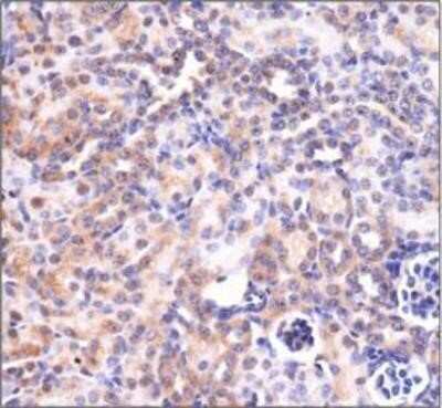 Immunohistochemistry: Mas Antibody - BSA Free [NLS1531]