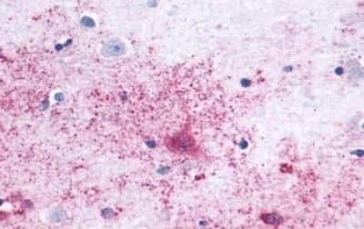 Immunohistochemistry-Paraffin: Mas Antibody [NBP3-14397]