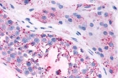 Immunohistochemistry-Paraffin: Mas Antibody [NBP3-14397]