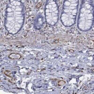 Immunohistochemistry-Paraffin: Mas Antibody [NBP3-17188]