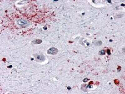 Immunohistochemistry-Paraffin: Mas Antibody - BSA Free [NLS1531]