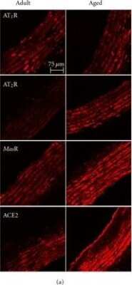 Immunohistochemistry-Paraffin: Mas Antibody - BSA Free [NLS1531]