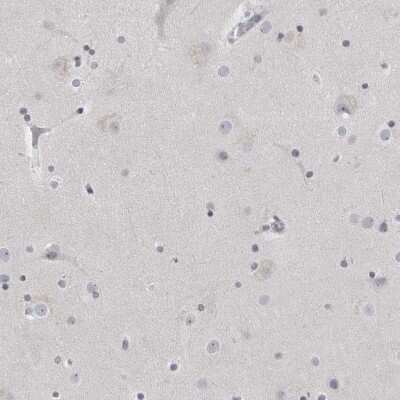 Immunohistochemistry-Paraffin: Matrilin-1 Antibody [NBP1-84433]