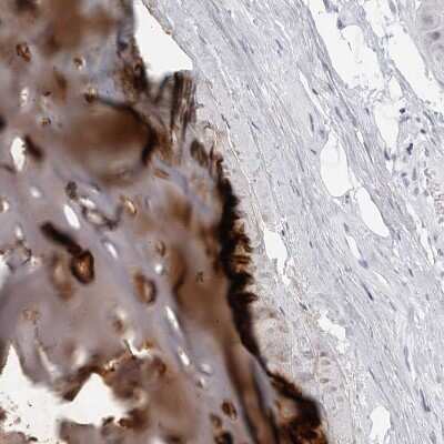 Immunohistochemistry-Paraffin: Matrilin-1 Antibody [NBP1-84433]