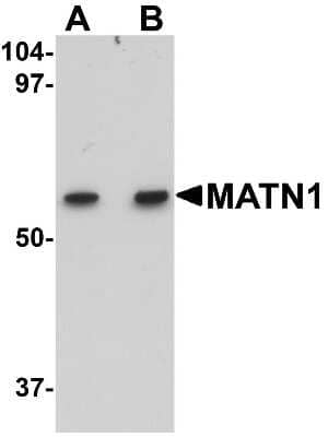 Western Blot: Matrilin-1 AntibodyBSA Free [NBP1-77350]