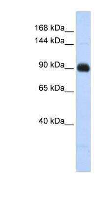 Western Blot: Matrilin-2 Antibody [NBP1-53142]