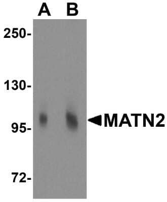 Western Blot: Matrilin-2 AntibodyBSA Free [NBP1-76328]