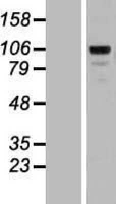 Western Blot: Matrilin-2 Overexpression Lysate [NBL1-12915]