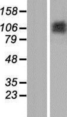 Western Blot: Matrilin-2 Overexpression Lysate [NBP2-11326]