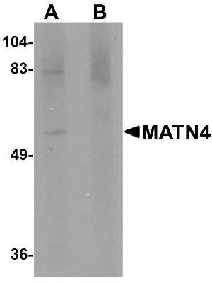 Western Blot: Matrilin-4 AntibodyBSA Free [NBP1-77012]