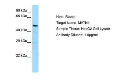 Western Blot: Matrilin-4 Antibody [NBP1-98551]