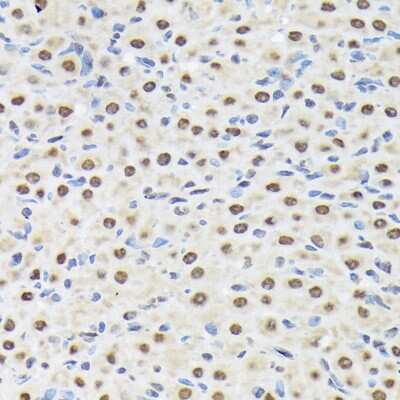Immunohistochemistry-Paraffin: Matrin 3 Antibody (10O1D1) [NBP3-15307]