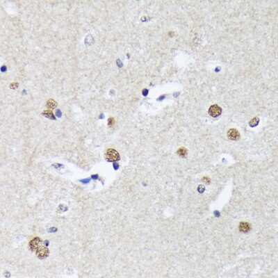 Immunohistochemistry-Paraffin: Matrin 3 Antibody (10O1D1) [NBP3-15307]