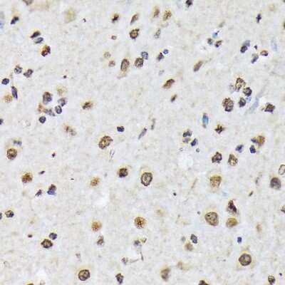 Immunohistochemistry-Paraffin: Matrin 3 Antibody (10O1D1) [NBP3-15307]