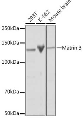 Western Blot: Matrin 3 Antibody (10O1D1) [NBP3-15307]