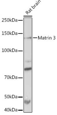 Western Blot: Matrin 3 Antibody (10O1D1) [NBP3-15307]